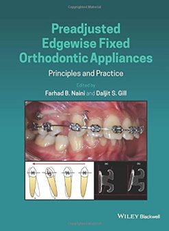 Preadjusted Edgewise Fixed Orthodontic Appliances: Principles and Practice (Original PDF from Publisher)