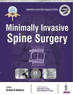 Minimally Invasive Spine Surgery (ORIGINAL PDF from Publisher)