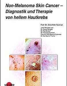 Non-Melanoma Skin Cancer – Diagnostik und Therapie von hellem Hautkrebs (UNI-MED Science) (German Edition) (Original PDF from Publisher)