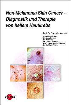 Non-Melanoma Skin Cancer – Diagnostik und Therapie von hellem Hautkrebs (UNI-MED Science) (German Edition) (Original PDF from Publisher)