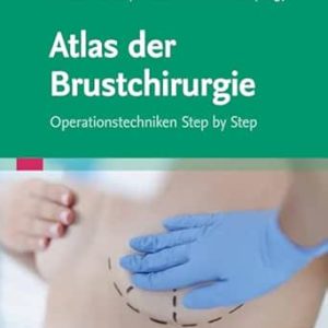 Atlas der Brustchirurgie: Operationstechniken Step by Step (German Edition) (True PDF from Publisher)