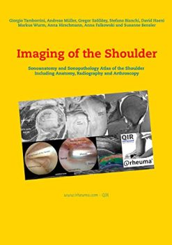 Imaging of the Shoulder: Sonoanatomy and Sonopathology Atlas of the Shoulder Including Anatomy, Radiography and Arthroscopy (ePub+Converted PDF)