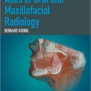 Atlas of Oral and Maxillofacial Radiology