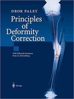 Principles of Deformity Correction (Original PDF from Publisher)