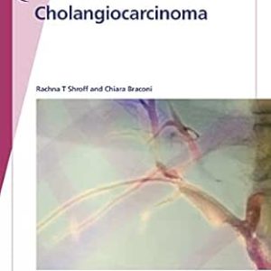 Fast Facts: Cholangiocarcinoma: Diagnostic and Therapeutic Advances Are Improving Outcomes (Original PDF from Publisher)