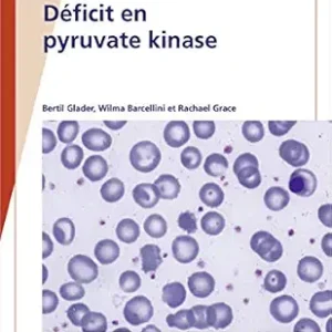 Fast Facts: Déficit en pyruvate kinase: Sensibilisation à cette maladie génétique rare (French Edition) (EPUB)