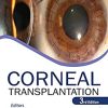 Corneal Transplantation, 3rd edition (Original PDF from Publisher)