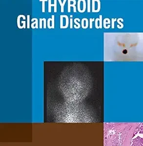Principles and Practices of Thyroid Gland Disorders (Original PDF from Publisher)