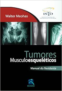 Tumores Musculoesqueléticos: Manual do Residente, 1st Edition (Original PDF from Publisher)