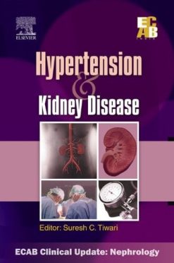 Hypertension and Kidney Disease – ECAB (Original PDF from Publisher)