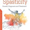 Spasticity: Causes, Diagnosis and Treatment (Original PDF from Publisher)
