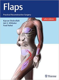 Flaps: Practical Reconstructive Surgery (Original PDF from Publisher)