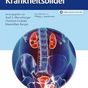 Referenz Urologie – Krankheitsbilder (German Edition) (Original PDF from Publisher)