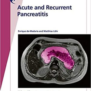 Fast Facts: Acute and Recurrent Pancreatitis: Using evidence to support treatment (ORIGINAL PDF from Publisher)