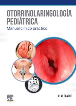 Otorrinolaringología pediátrica (Original PDF from Publisher)
