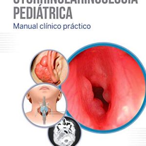 Otorrinolaringología pediátrica (Original PDF from Publisher)
