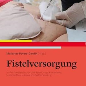 Fistelversorgung: Mit Praxisbeispielen, 2nd Edition (Original PDF from Publisher)
