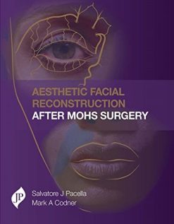 Aesthetic Facial Reconstruction After Mohs Surgery (Converted PDF)