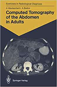 Computed Tomography of the Abdomen in Adults: 85 Radiological Exercises for Students and Practitioners (Exercises in Radiological Diagnosis) (Original PDF from Publisher)