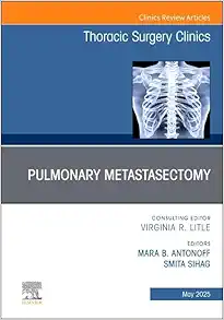 Pulmonary Metastasectomy, An Issue of Thoracic Surgery Clinics (Volume 35-2) (The Clinics: Internal Medicine, Volume 35-2) (True PDF from Publisher)