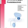 Androgenblockade beim hormonabhängigen Prostatakarzinom (UNI-MED Science) (German Edition) (Original PDF from Publisher)
