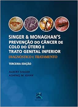 Singer e Monaghan’s Prevenção do Câncer de Colo do Útero e Trato Genital Inferior: Diagnóstico e Tratamento, 3rd Edition (Original PDF from Publisher)