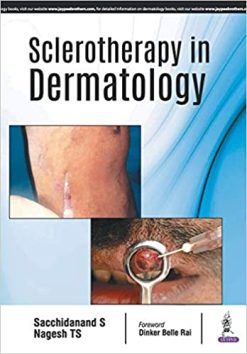 Sclerotherapy in Dermatology (Original PDF from Publisher)