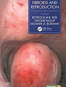 Fibroids and Reproduction (ORIGINAL PDF from Publisher+Videos)
