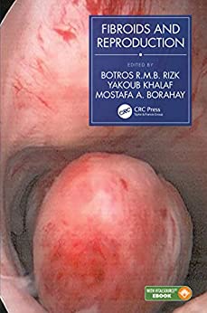 Fibroids and Reproduction (ORIGINAL PDF from Publisher+Videos)