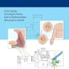 Modern Surgical Management of Chronic Lymphedema (EPUB)