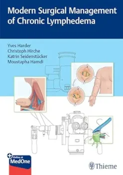 Modern Surgical Management of Chronic Lymphedema (EPUB)