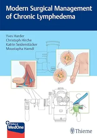 Modern Surgical Management of Chronic Lymphedema (EPUB)