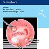 Histeroscopia: Técnica & Arte (Original PDF from Publisher)
