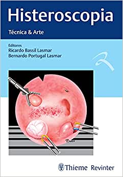 Histeroscopia: Técnica & Arte (Original PDF from Publisher)