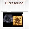 Atlas of breast ultrasound (Original PDF from Publisher)
