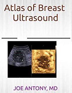 Atlas of breast ultrasound (Original PDF from Publisher)