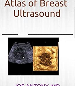 Atlas of breast ultrasound (Original PDF from Publisher)