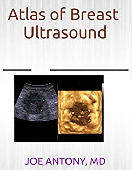 Atlas of breast ultrasound (Original PDF from Publisher)