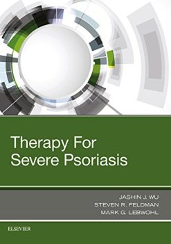 Therapy for Severe Psoriasis (PDF)