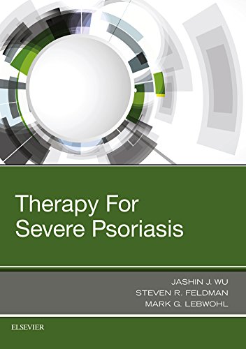 Therapy for Severe Psoriasis (PDF)