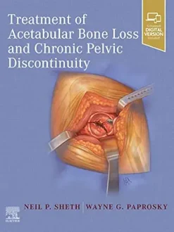 Treatment of Acetabular Bone Loss and Chronic Pelvic Discontinuity (EPUB)