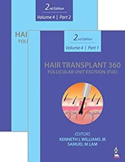 Hair Transplant 360: Follicular Unit Excision (FUE) Volume 4 | Part 1 & 2, 2nd Edition(Original PDF from Publisher)