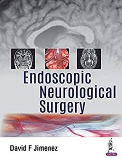 Endoscopic Neurological Surgery (Original PDF from Publisher)