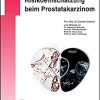 Diagnostik und Risikoeinschätzung beim Prostatakarzinom (UNI-MED Science) (German Edition) (Original PDF from Publisher)