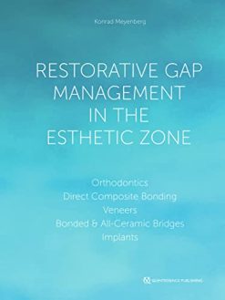 Restorative Gap Management in the Esthetic Zone: Orthodontics | Direct Composite Bonding | Veneers | Bonded & All-Ceramic Bridges | Implants (EPUB)