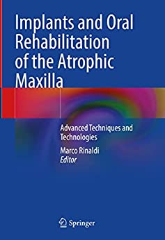 Implants and Oral Rehabilitation of the Atrophic Maxilla: Advanced Techniques and Technologies (Original PDF from Publisher)