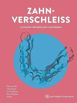 Zahnverschleiß: Diagnose | Behandlung | Nachsorge (German Edition) (EPUB)