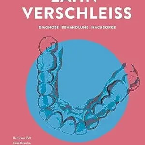 Zahnverschleiß: Diagnose | Behandlung | Nachsorge (German Edition) (EPUB)