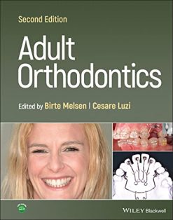 Adult Orthodontics, 2nd Edition (Original PDF from Publisher)