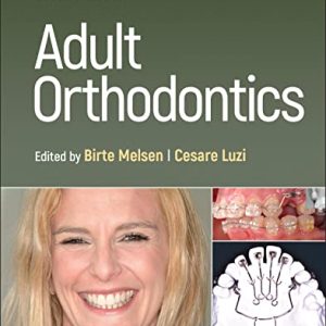 Adult Orthodontics, 2nd Edition (Original PDF from Publisher)
